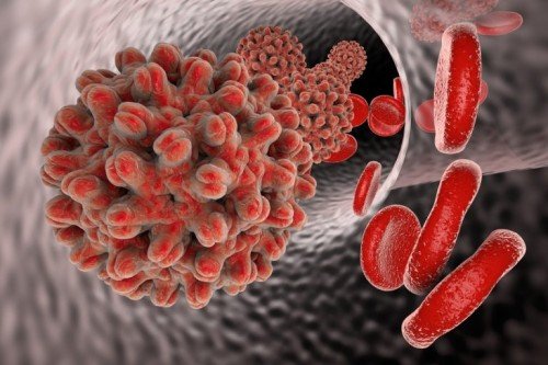 Hepatit, karaciğeri etkileyen viral bir enfeksiyondur